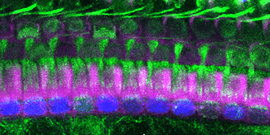 tubulin